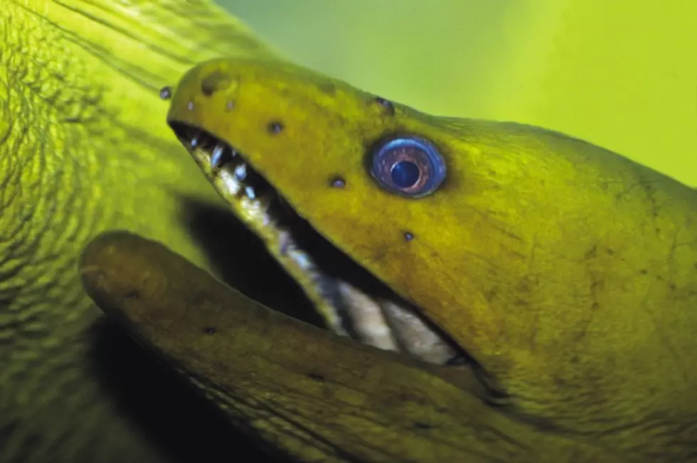 Eel Gets Lodged Up Guy&#8217;s Butt