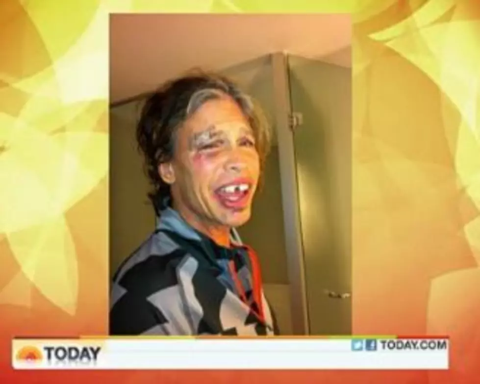 Steven Tyler Looks Like He Got the Crap Beat Out of Him After the Shower Fall [VIDEO]