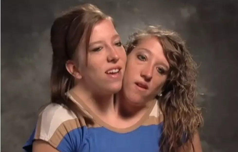 Conjoined Twins Get Reality Show On TLC [VIDEO]