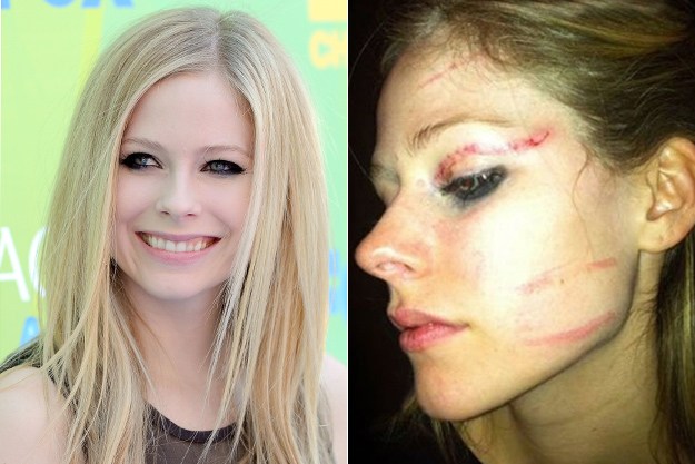 avril lavigne beat up. Avril Lavigne Jason Merritt, Getty Images / Idolator