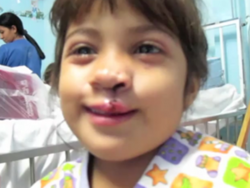 Little Girl&#8217;s Touching Reaction to Her New Face After Cleft Lip Surgery [VIDEO]