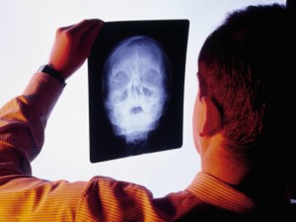 Head Trauma May Increase Chance of Alzheimer&#8217;s