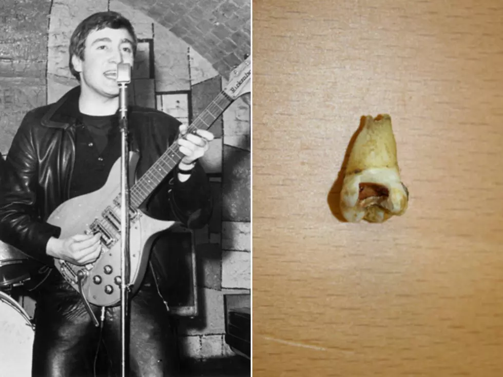 John Lennon&#8217;s Tooth Slated for Auction