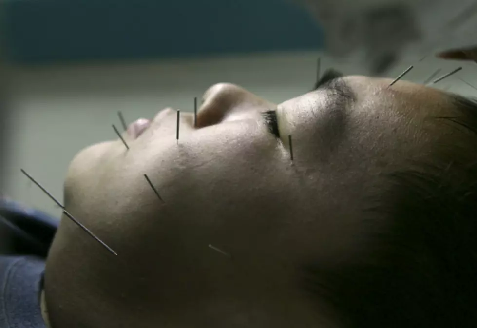 Acupuncture Now Deemed Safe for Children