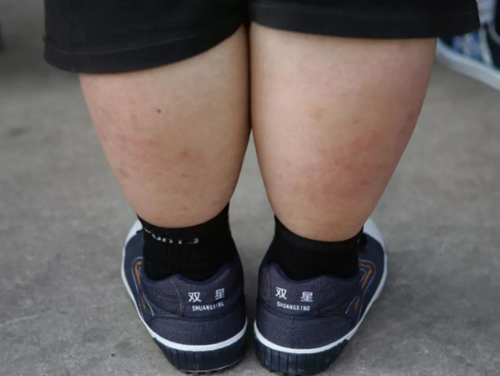 Should an Obese Child Be Taken From His Parents?