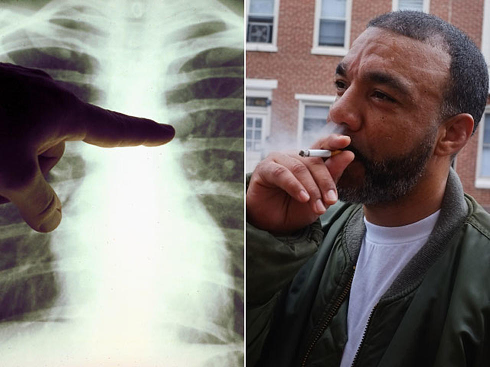 Lung Cancer Is Officially No Longer Just a &#8216;Smoker&#8217;s Disease&#8217;