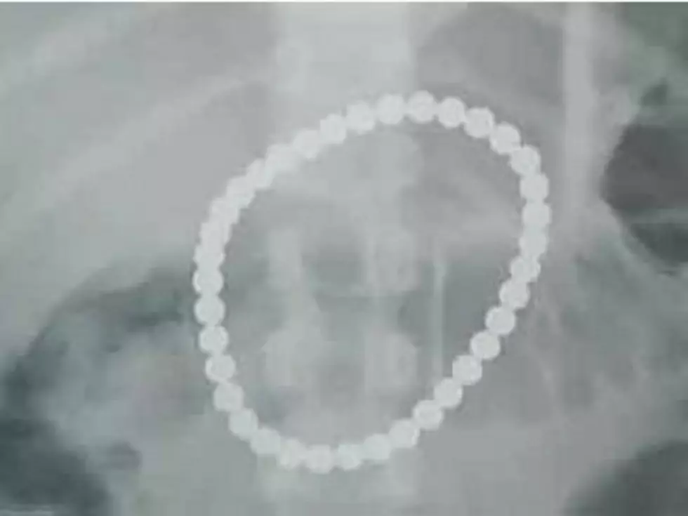 Toddler Amazingly Survives After Swallowing 37 BuckyBalls
