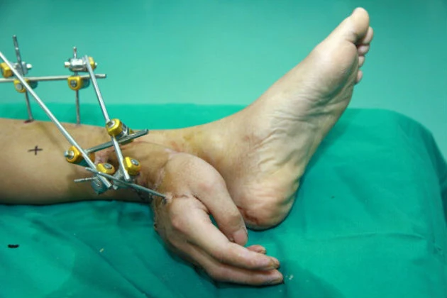 [Image: severed-hand-on-ankle.jpg]